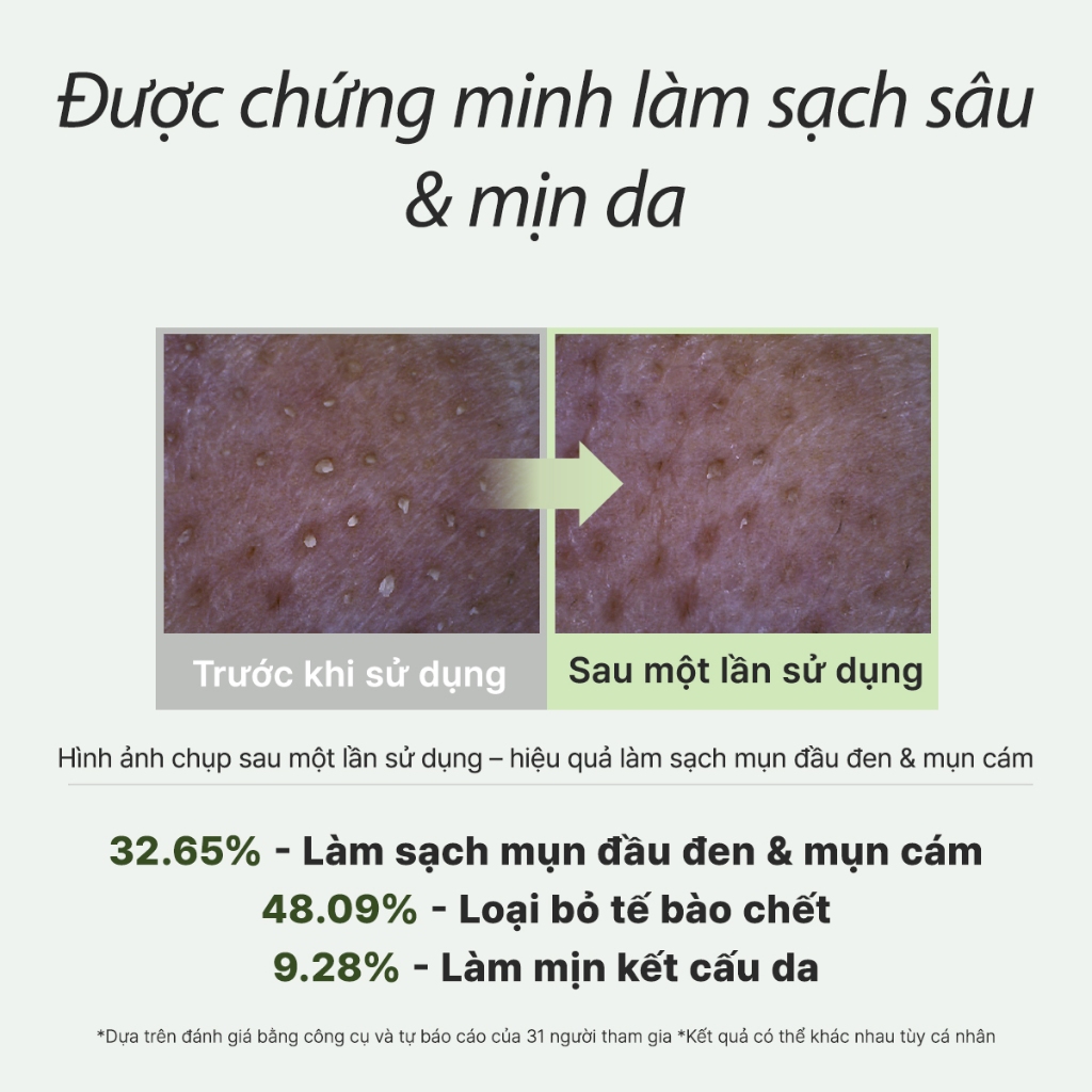[Arencia] Sữa rửa mặt Mochi gạo xanh tươi 120g | Làm sạch, Cấp ẩm, loại bỏ mụn đầu đen