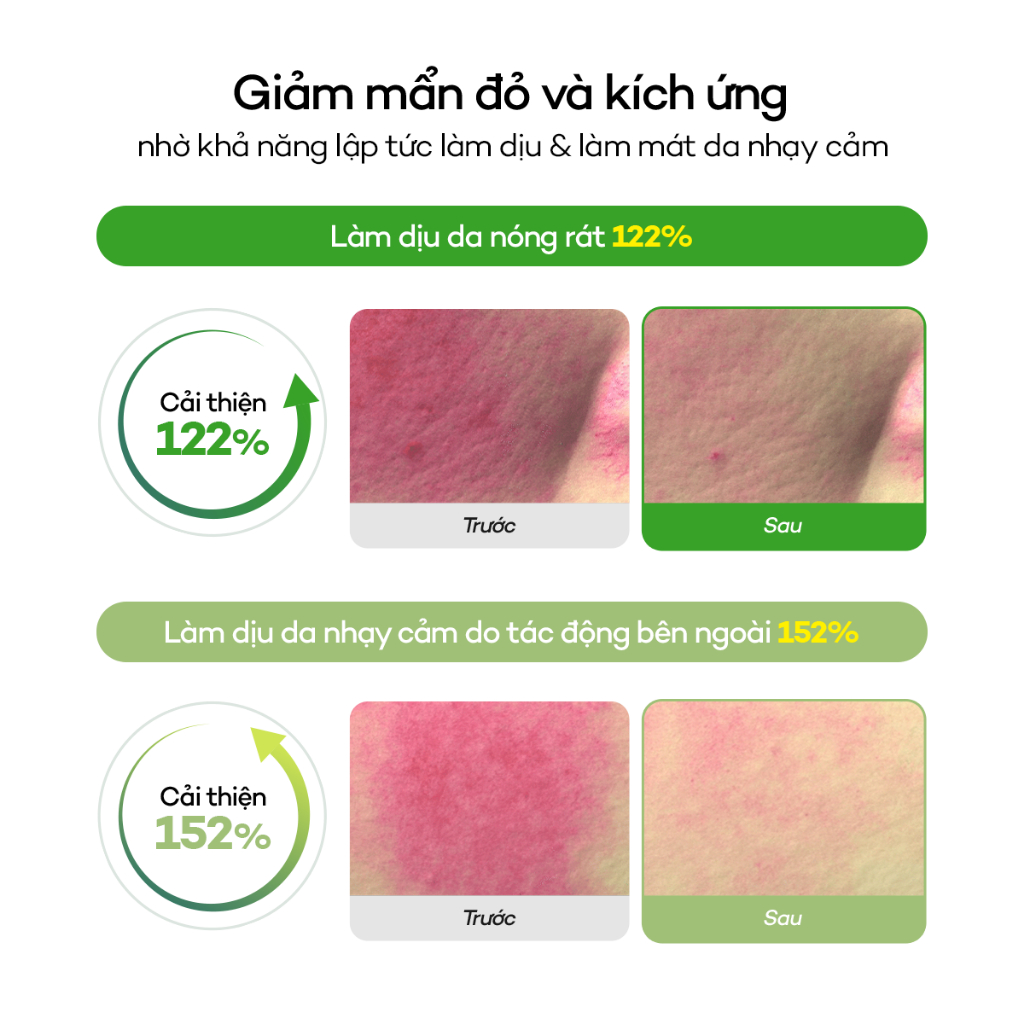 [DEWYTREE] Toner Pad Dưỡng Sáng Mờ Thâm & Làm Dịu Da AC Deep Blemish Green Calming Pad 80 Miếng