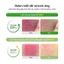 Toner Pad Dưỡng Sáng Mờ Thâm & Làm Dịu Da AC Deep Blemish Green Calming Pad 80 Miếng