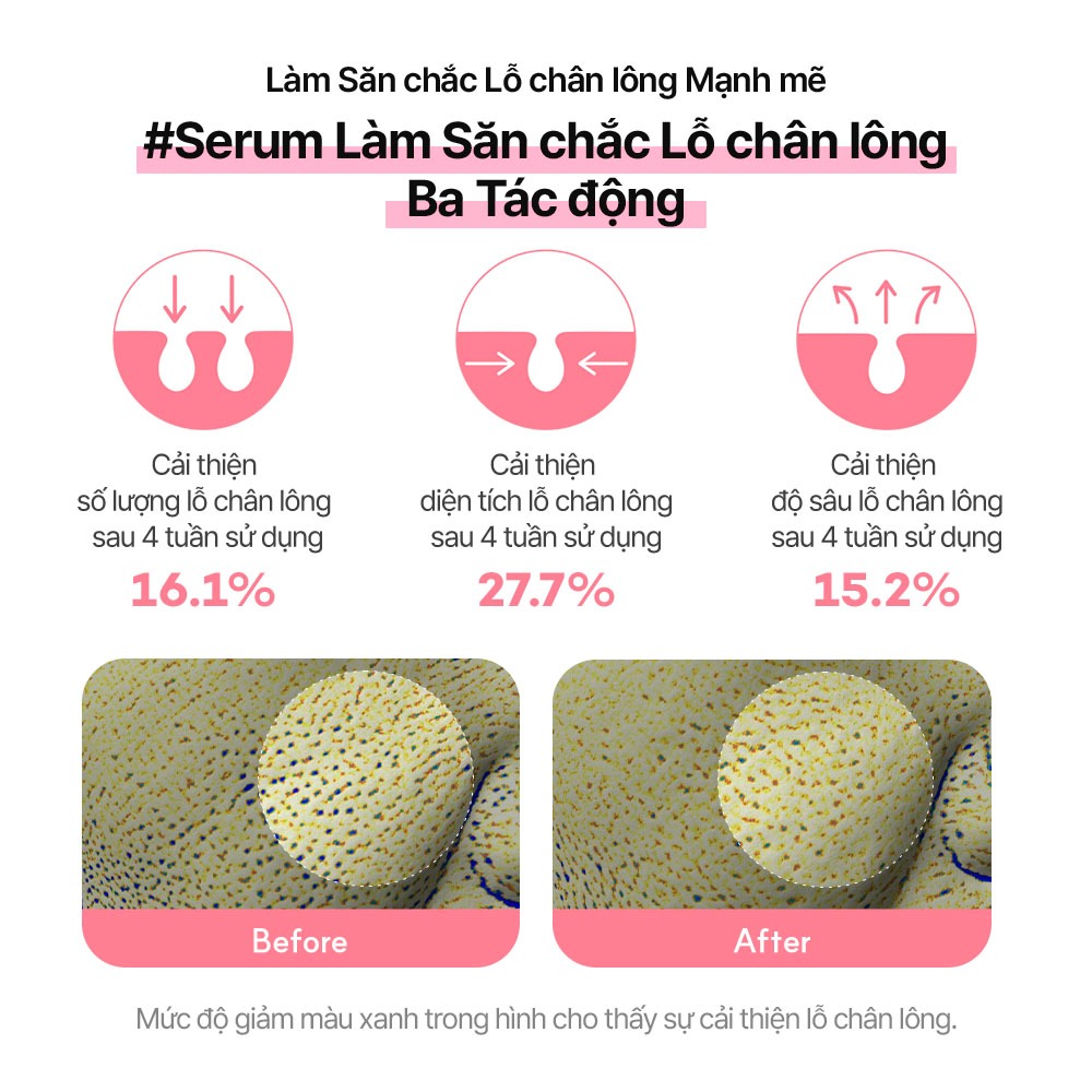 [STANDARD SEOUL] Serum dưỡng săn chắc da, se khít lỗ chân lông Collagen PDRN Bakuchiol (30ml)