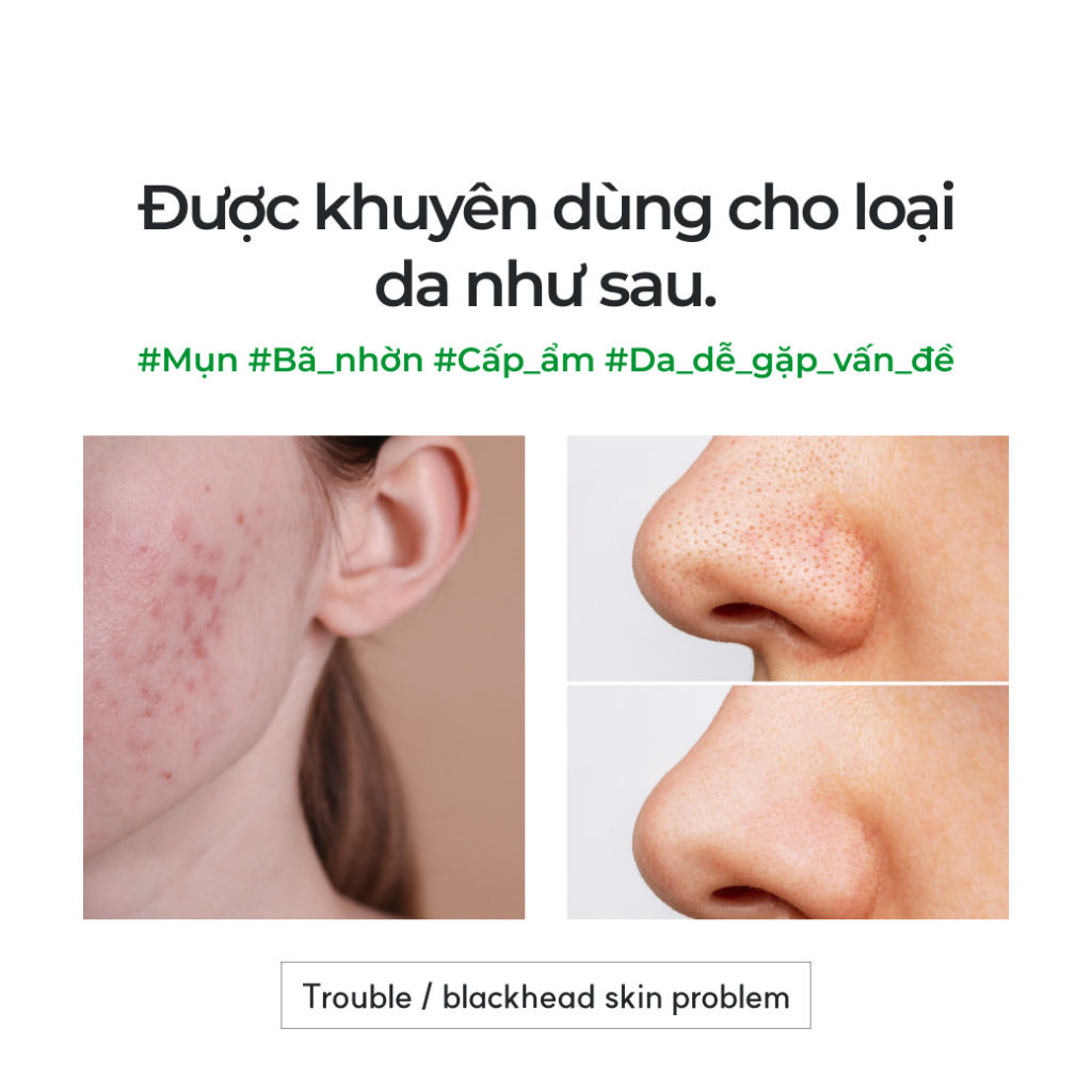Kem Dưỡng NEUL20S cho Da Mụn Centelsome 5X – Cấp Ẩm & Phục Hồi Da Nhạy Cảm