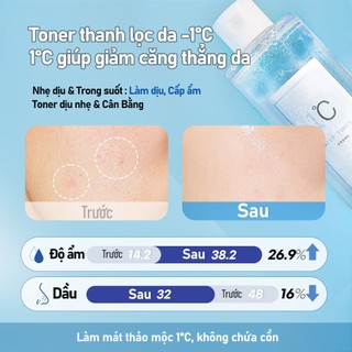 NATURAL SHINE Nước Cân Bằng Chăm Sóc Da 3 Bước Giảm Căng Thẳng -1℃ 300ml