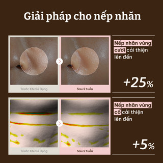 [Dr.Reju-All Official] PD2 Mặt Nạ PDRN Phục Hồi Da 4ea*1BOX | Chống lão hóa, Da khô, Phục hồi hàng rào da 1.200ppm, Mặt nạ sợi mềm, Dùng cho mặt & cổ, Tinh chất đậm đặc trong mặt nạ Niacinamide,Collagen, Peptide
