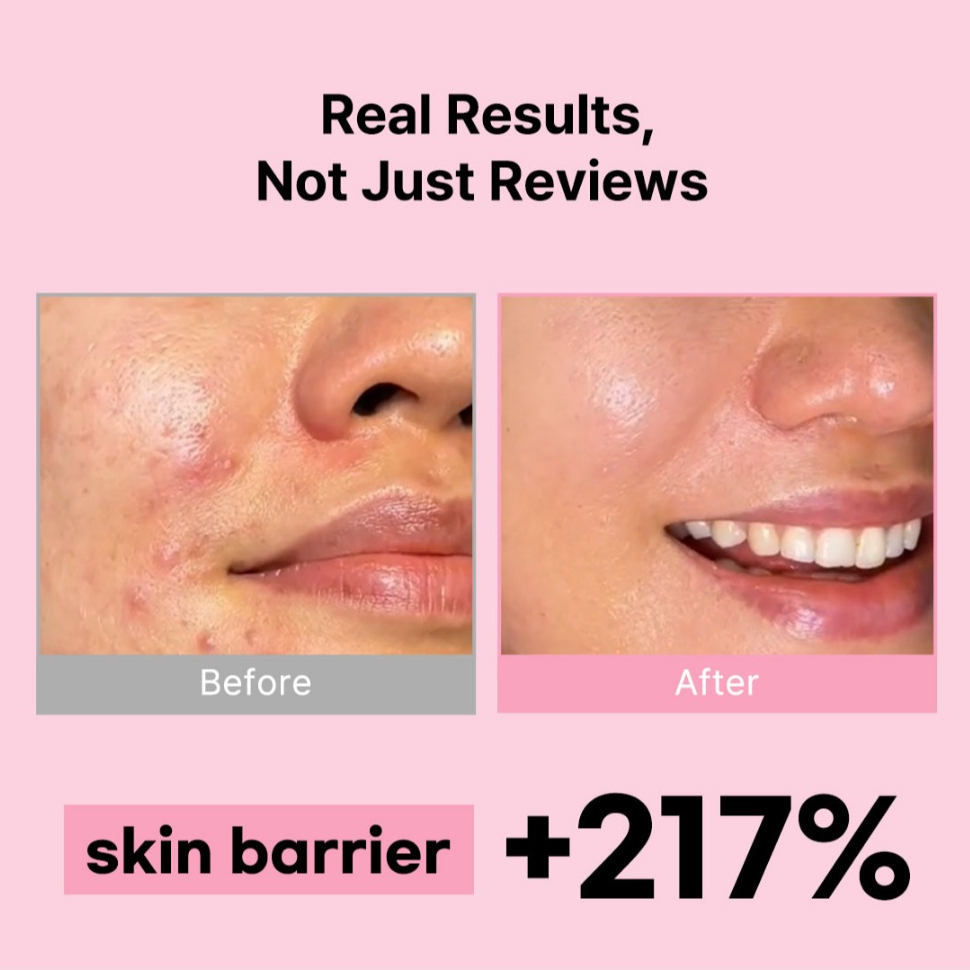 [fvrts] Serum phục hồi hàng rào Ceramide | Serum dưỡng ẩm cho làn da nhạy cảm, Su Boon Jo Serum (30ml)