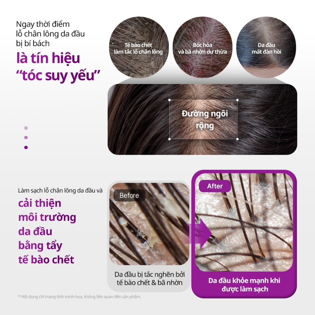 [VT] Dầu gội tăng cường tóc Reedle Shot Peptide 500ml CICA REEDLE X Peptide Chăm sóc rụng tóc Làm sạch da đầu & tẩy tế bào chết [Trung tâm mua sắm chính thức]