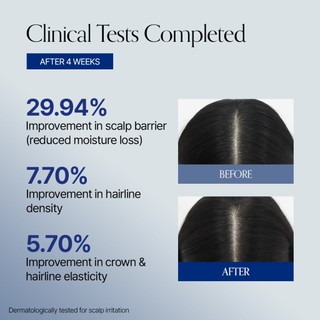 [GROWUS Official] Tinh Chất Recover Therapy Hair Booster Serum EX 14ml | Giảm Rụng Tóc | Công Nghệ Biotin Spicule & Đầu Lăn Massage 3 Viên | Giúp Tóc Chắc Khỏe & Bồng Bềnh