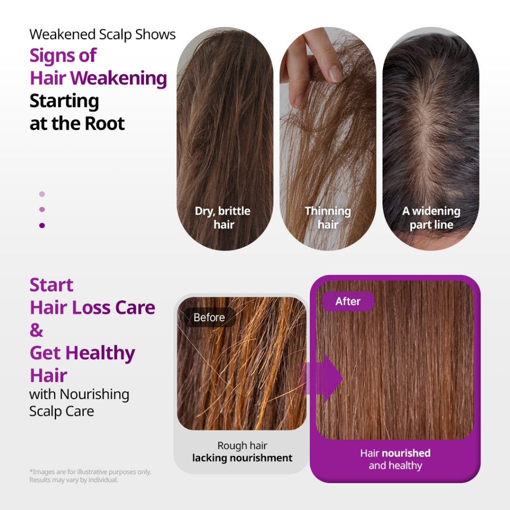 [VT] Reedle Shot Peptide Hair Boosting Da Đầu Gói 4ml [Trung Tâm Thương Mại Chính Thức]
