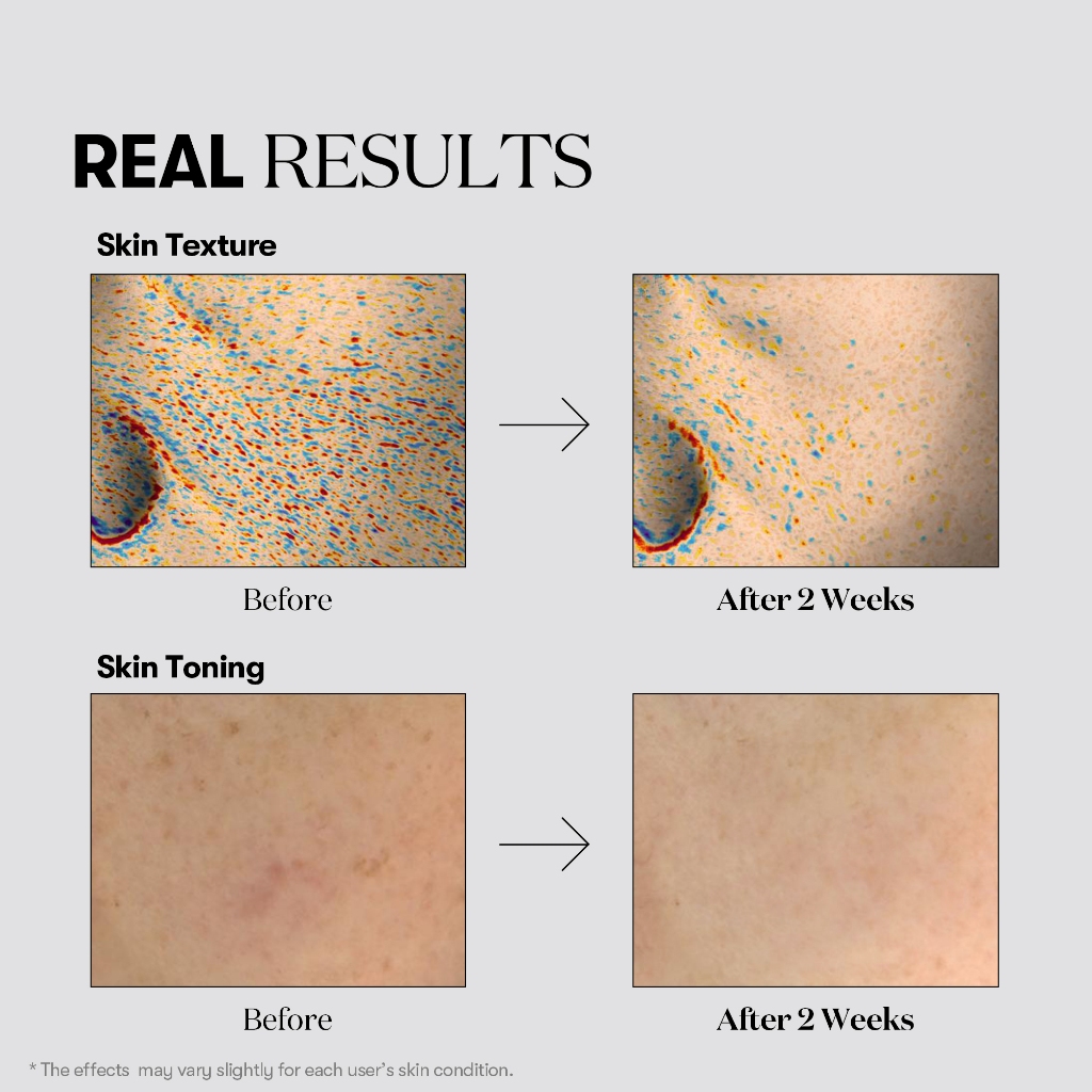 [VT] Serum Dark Spot Niacinamide Tranexamic Acid Brightening TX-Toning Serum 15ml
