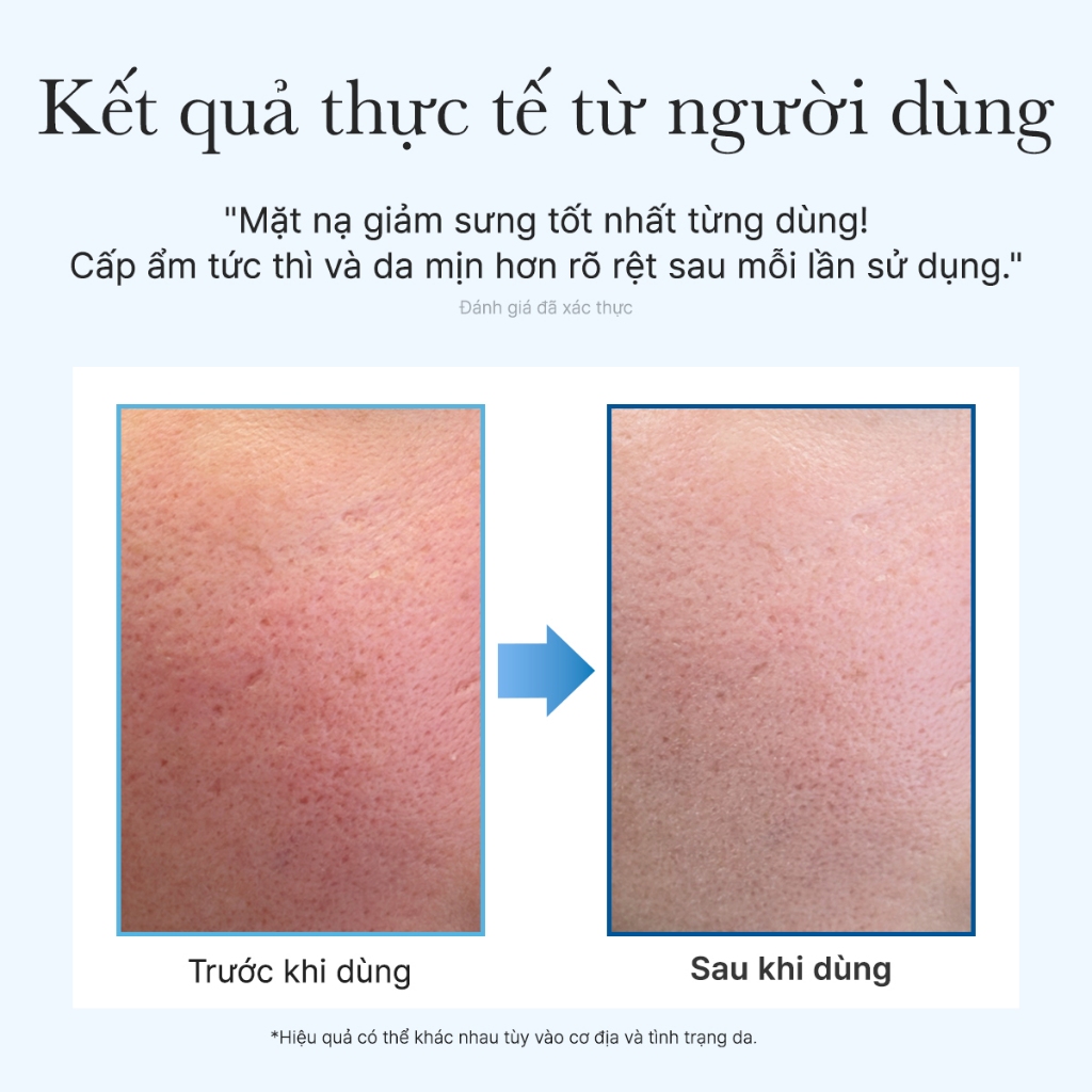 [Arencia] Blue Collagen Cryo Jello Mask 4ea