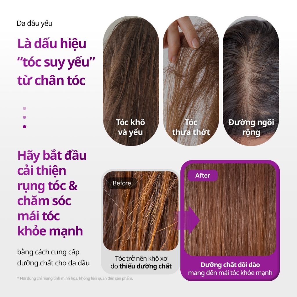[VT] Gói tăng cường tóc Reedle Shot Peptide 250ml CICA REEDLE X Peptide Chăm sóc rụng tóc Nuôi dưỡng tóc [Trung tâm mua sắm chính thức]