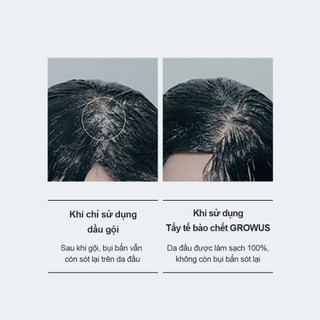[GROWUS Chính hãng] Tẩy tế bào chết da đầu muối biển giảm gàu nhờn, làm mát da đầu, tóc tơi, khoáng chất cung cấp dưỡng chất cho tóc và da đầu GROWUS Sea Salt Therapy Scalp Scaler 30g / 120g / 250g