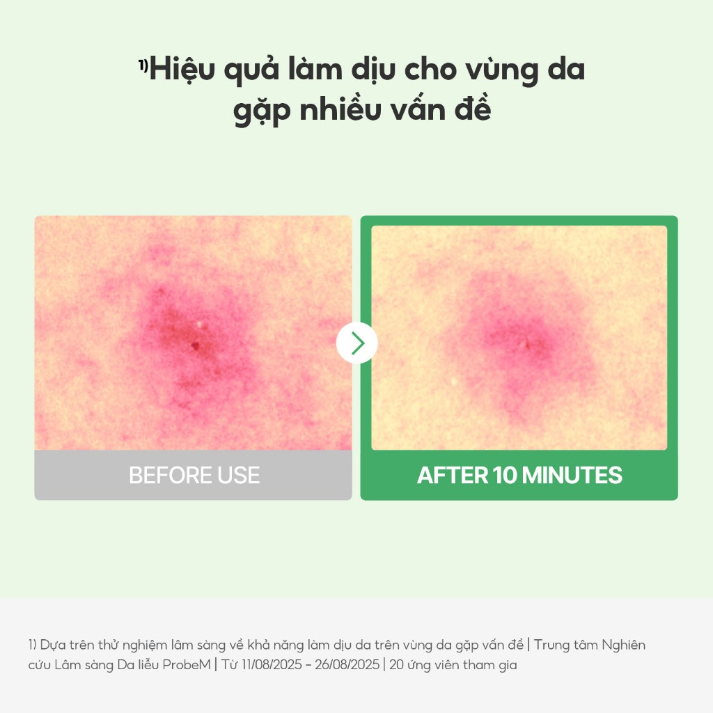 [Hàng Tặng Kèm Không Bán] Torriden Mặt nạ kiểm soát da BALANCEFUL CICA, 1 miếng, Mask
