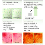 [KOL-VT] Tinh Chất Vi Kim Reedle Shot 100 / 300 / 700 – Serum Tái Tạo Da, Phục Hồi, Căng Bóng, Chiết Xuất Rau Má (Centella) [Flagship Chính Hãng] — ảnh 3
