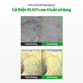 [SUNGBOON EDITOR] Green Tomato NMN Pore Peeling Pad 60 chiếc
