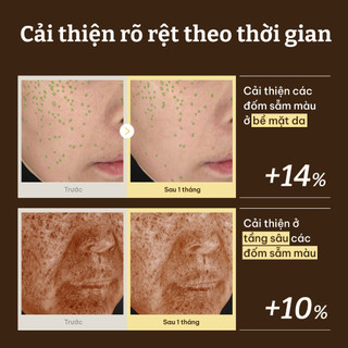 [Dr.Reju-All Official] [MINI] EP2 Tinh Chất HPR Làm Sáng & Chống Nhăn 5ml | Phục hồi da, Giảm nếp nhăn, Săn chắc da, Dược mỹ phẩm Hàn Quốc, Không gây mụn Retinol,Niacinamide,TXA