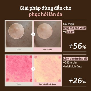 [Dr.Reju-All Official] [MINI] PD3 Kem Dưỡng PDRN Phục Hồi & Tái Tạo Da 5ml | Chống lão hóa, Da khô, Da nhạy cảm, 1.200ppm, Dược mỹ phẩm Hàn Quốc, Không gây mụn Panthenol, Niacinamide,Collagen