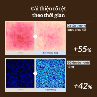 [Dr.Reju-all Official] [MINIX2] SD4 Hiệu Quả Cao LC-Ceramide Kem Phục Hồi Hàng Rào Da 5ml X 2 | Da khô, Dưỡng ẩm Dược mỹ phẩm Hàn Quốc, Không gây mụn Panthenol, Niacinamide