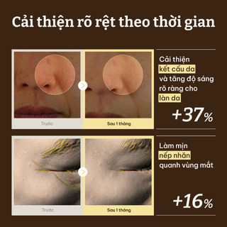 [Dr.Reju-All Official] [MINI] EP2 Tinh Chất HPR Làm Sáng & Chống Nhăn 5ml | Phục hồi da, Giảm nếp nhăn, Săn chắc da, Dược mỹ phẩm Hàn Quốc, Không gây mụn Retinol,Niacinamide,TXA