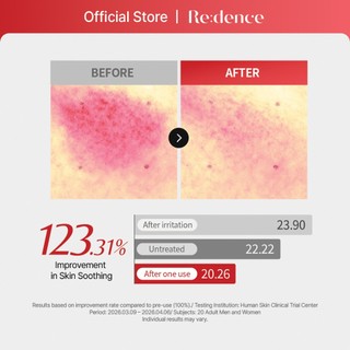[Redence] Azelaic Cica Serum 18.3% 30ml - Giảm Mụn, Làm Dịu & Phục Hồi Da