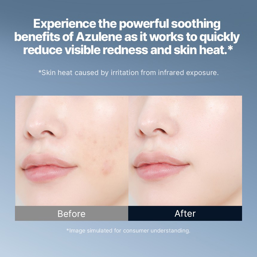 TONYMOLY Azulene Anti Blemish Calming Booster Toner 200ml rắc rối chăm sóc mụn làm dịu