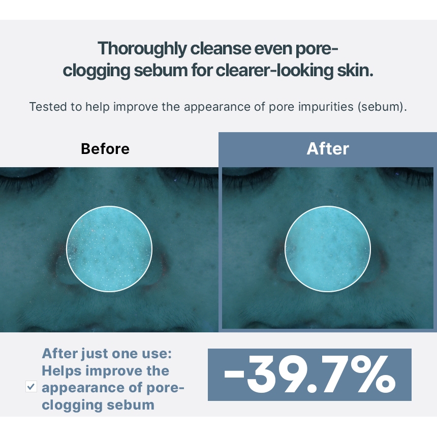 TONYMOLY Azulene Anti Blemish Acne Foam Cleanser 150ml Làm dịu mụn Sebum Care Sữa rửa mặt thực vật