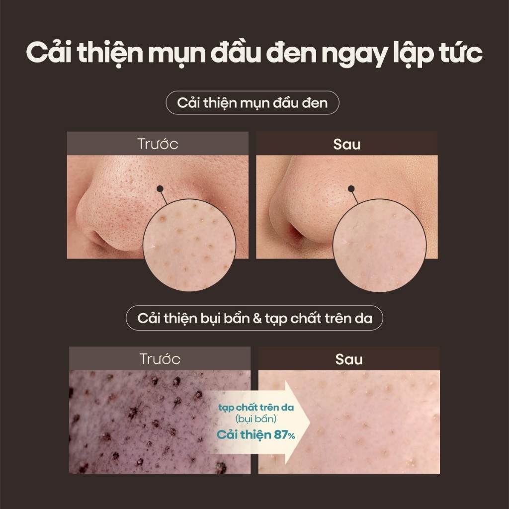 [OBgE Chính Hãng] Sáp Tẩy Tế Bào Chết Mụn Đầu Đen 20g, Làm sạch mụn đầu đen, Tẩy da chết dịu nhẹ