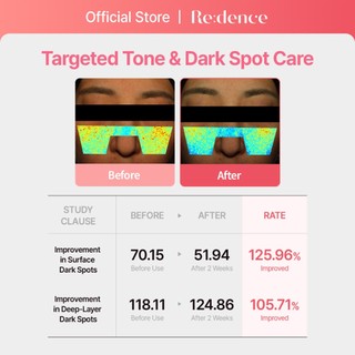 [Redence] Kem Dưỡng Mờ Thâm, Phục Hồi Da & Làm Sáng 80ml - Tone & Spot Recovery Cream