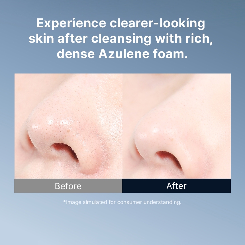 TONYMOLY Azulene Anti Blemish Acne Foam Cleanser 150ml Làm dịu mụn Sebum Care Sữa rửa mặt thực vật