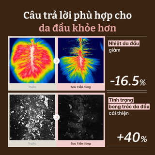 [Dr.Reju-All Official] PD0 Tinh Chất Da Đầu PDRN Cho Tóc Dày Khỏe 15ml | Giảm rụng tóc, Tóc mỏng đầu lăn