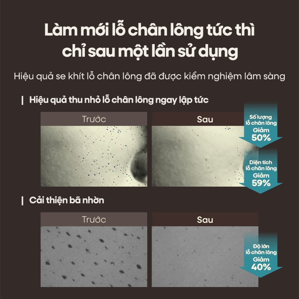 [OBgE Chính Hãng] Sáp Tẩy Tế Bào Chết Mụn Đầu Đen 20g, Làm sạch mụn đầu đen, Tẩy da chết dịu nhẹ
