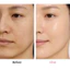 SISKELI PDRN Collagen Regener Toner 300ml + Ampoule 50ml Bộ chăm sóc dưỡng ẩm & rạng rỡ
