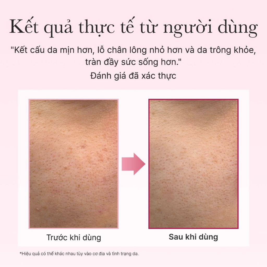 [Arencia] Tinh chất PDRN Booster Shot 10ml