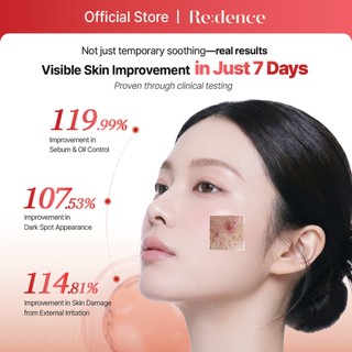 [Redence] Azelaic Cica Serum 18.3% 30ml - Giảm Mụn, Làm Dịu & Phục Hồi Da