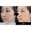 ORB Ultra Pink Collagen Essence 200ml Hydrating Peptide Chăm sóc da Chăm sóc độ ẩm hàng ngày Bộ 3 món