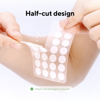 Miếng dán mụn caraseoul Spot Patches 44 miếng