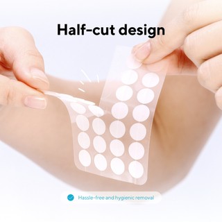 Miếng dán mụn caraseoul Spot Patches 102 miếng