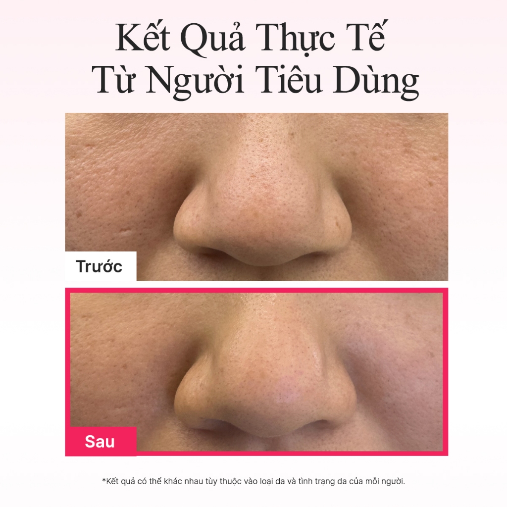 [Arencia] Mặt nạ Jello Collagen đỏ (4ea)
