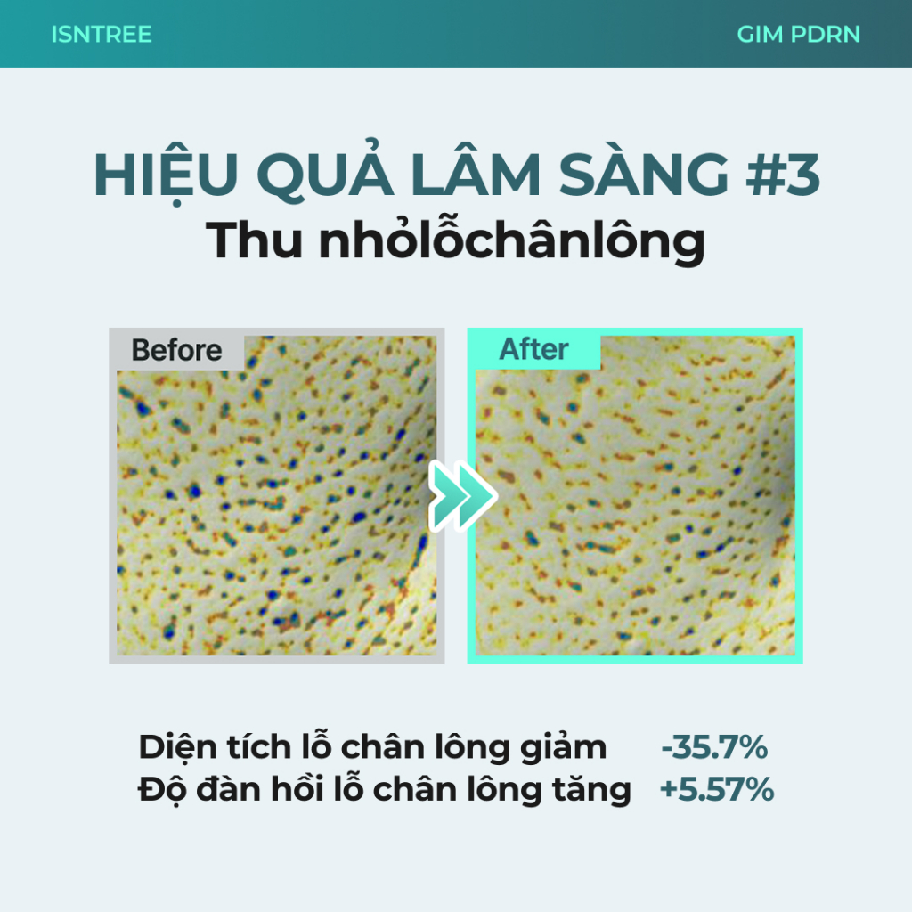 [NEW] ISNTREE Mặt Nạ Ngủ PDRN Rong Biển 80ml