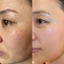 Serum tái tạo nhân sâm, Ginseng Herbal Skin Peel cao cấp Giảm Mụn, Mờ Thâm, Phục Hồi da,