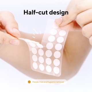 Miếng dán mụn caraseoul Spot Patches 74 miếng