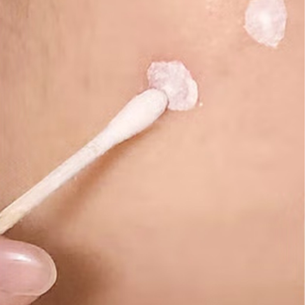 [a.solution] Chấm Mụn Rau Diếp Cá Calamine Spot Treatment 10ml