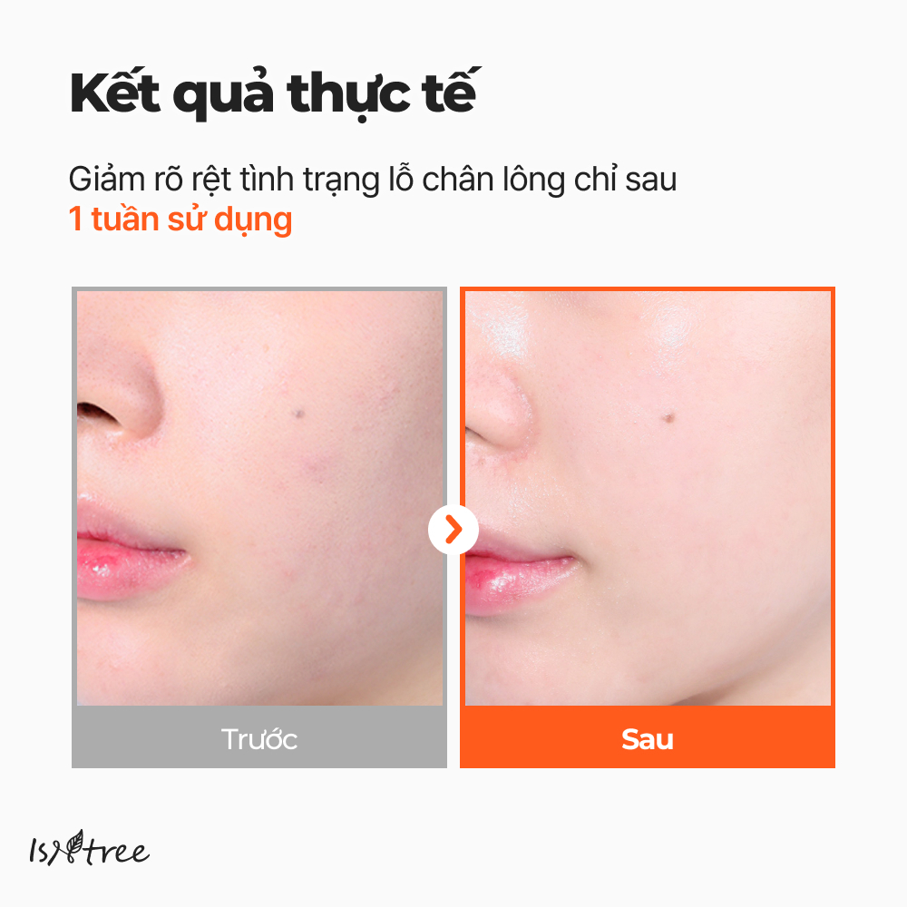 ISNTREE Serum Hyper Niacinamide 20% 20ml