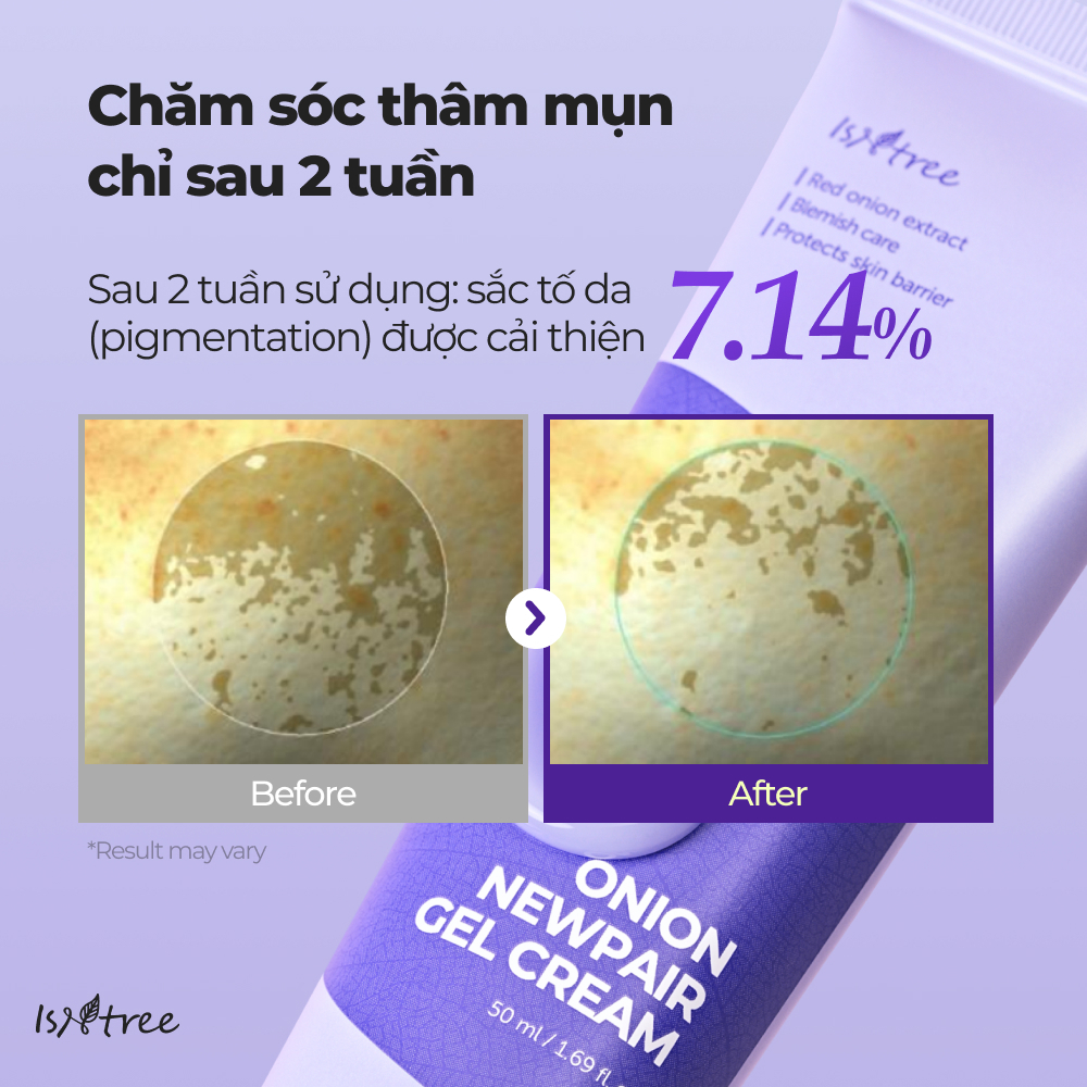ISNTREE Gel Dưỡng Ẩm Hành Tím Phục Hồi Da 50ml