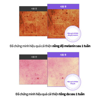 [SUNGBOON EDITOR] Meoru Podo Vita C Dark Spot Cream 50ml