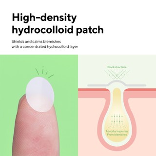 Miếng dán mụn caraseoul Spot Patches 44 miếng