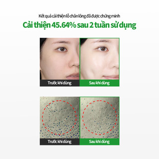 [SUNGBOON EDITOR] SBEDT NMN Nước Hoa Hồng Làm Dịu & Cấp Ẩm Lỗ Chân Lông Green Tomato Toner 350ml