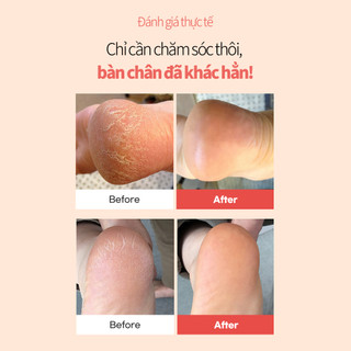 [SUNGBOON EDITOR] Thỏi dưỡng gót chân bơ hạt mỡ Shea Butter Baby Foot Stick 20g