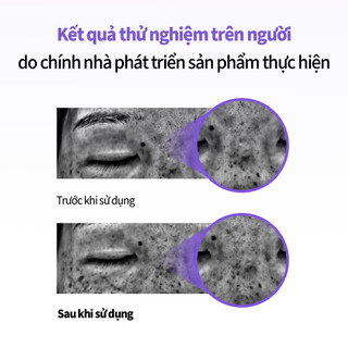 [SUNGBOON EDITOR] Meoru Podo Vita C Dark Spot Cream 50ml