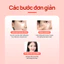 Miếng dán AC Magiê (Nhỏ, 10 miếng vá) / Loại bỏ mụn nhanh chóng / Da phục hồi 8 giờ / Miếng dán kim / Miếng dán lúm đồng tiền