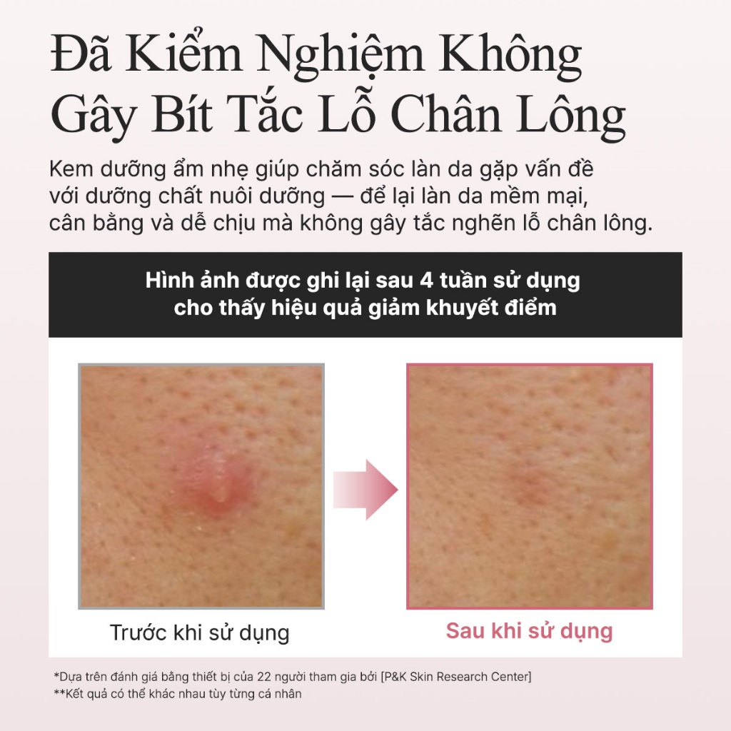 [Arencia] Sữa Dưỡng Mượt Đỏ 5 200ml